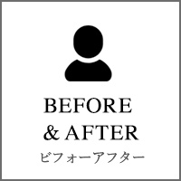 新宿でおしり痩せならダイエットウーマンのBEFORE&AFTER VOICE ビフォーアフター